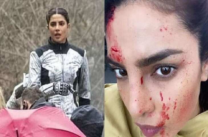 &nbsp;खून से लथपथ प्रियंका का माथा, चेहरे पर नीलापन देख फेंस को लगा झटका!