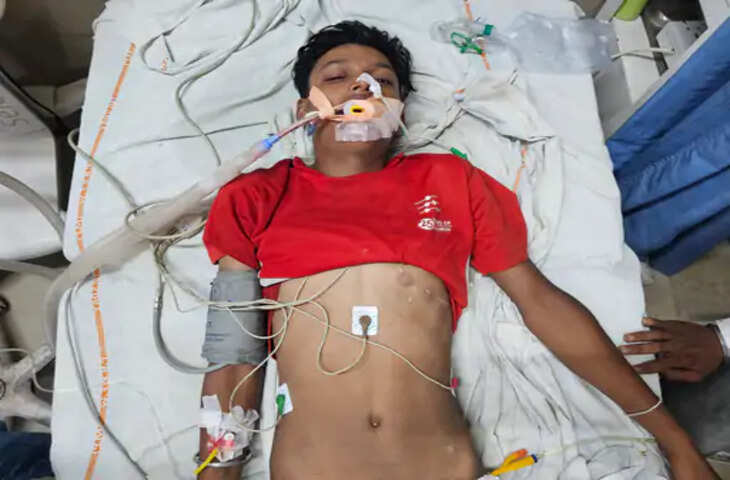 मध्य प्रदेश के मंदसौर जिले के सीतामऊ थाना क्षेत्र के लदुना गांव में सोमवार रात एक दर्दनाक घटना सामने आई। यहां कोबरा सांप के काटने से 15 वर्षीय किशोर की हालत गंभीर हो गई। घटना के बाद परिजन उसे तुरंत अस्पताल ले जाने के बजाय पहले गांव के तेजा बाउजी मंदिर ले गए, जहां उपचार की उम्मीद में समय बीत गया। बाद में सर्पमित्र की सलाह पर किशोर को अस्पताल पहुंचाया गया, जहां उसका इलाज जारी है।  जानकारी के अनुसार, लदुना गांव निवासी 15 वर्षीय किशोर सोमवार रात किसी काम से बाहर गया था। इसी दौरान उसे जहरीले कोबरा सांप ने काट लिया। सांप के काटने के बाद किशोर की हालत बिगड़ने लगी और शरीर में जहर का असर दिखाई देने लगा। परिजन घबरा गए और उसे तुरंत अस्पताल ले जाने के बजाय गांव के तेजा बाउजी मंदिर लेकर पहुंचे।  ग्रामीणों के अनुसार, मंदिर में कुछ देर तक पारंपरिक तरीके से उपचार कराने का प्रयास किया गया। इस दौरान अस्पताल पहुंचने में देरी हो गई। जब किशोर की हालत ज्यादा बिगड़ने लगी तो परिजनों ने सर्पमित्र से संपर्क किया। सर्पमित्र ने स्थिति की गंभीरता को देखते हुए तुरंत अस्पताल ले जाने की सलाह दी।  इसके बाद परिजन किशोर को लेकर अस्पताल पहुंचे, जहां डॉक्टरों ने उसका इलाज शुरू किया। डॉक्टरों के मुताबिक, जहरीले सांप के काटने के कारण किशोर की हालत गंभीर बनी हुई थी और समय पर चिकित्सा उपचार मिलना बेहद जरूरी था।  घटना के बाद सर्पमित्र और स्वास्थ्य विशेषज्ञों ने लोगों से अपील की है कि सांप के काटने की स्थिति में झाड़-फूंक या अन्य देरी करने वाले उपायों में समय बर्बाद न करें। जहरीले सांप के काटने पर पीड़ित को जल्द से जल्द नजदीकी अस्पताल ले जाना चाहिए, ताकि एंटी स्नेक वेनम (एएसवी) सहित जरूरी इलाज समय पर मिल सके।  सीतामऊ थाना पुलिस को मामले की जानकारी मिलने के बाद घटना की जांच शुरू कर दी गई है। पुलिस ने ग्रामीणों से भी अपील की है कि इस तरह की घटनाओं में अंधविश्वास से बचते हुए तत्काल चिकित्सकीय सहायता लें।  बरसात के मौसम में सांपों के निकलने की घटनाएं बढ़ जाती हैं। ऐसे में ग्रामीण क्षेत्रों में लोगों को विशेष सावधानी बरतने की जरूरत है। विशेषज्ञों का कहना है कि सांप के काटने के बाद हर मिनट महत्वपूर्ण होता है और समय पर इलाज मिलने से पीड़ित की जान बचाई जा सकती है।