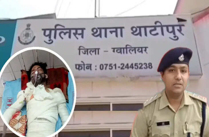 ग्वालियर में दिल दहला देने वाली वारदात: पेट्रोल देने से इनकार पर चौकीदार को जिंदा जलाने की कोशिश, पिता भी झुलसे