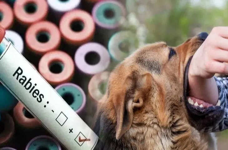 अब रेबीज से नहीं जाएगी जान, दिल्ली सरकार ने उठाया बड़ा कदम, युद्ध स्तर पर होगा काम
