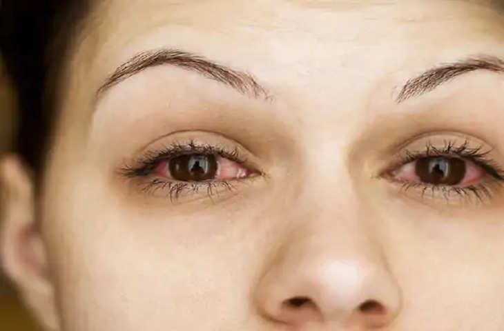 Thane 'प्रदेश में लाखों नेत्र रोगी! आंख की बाहरी झिल्ली का जीवाणु संक्रमण; क्या लक्षण हैं? आप देखभाल कैसे करते हैं?