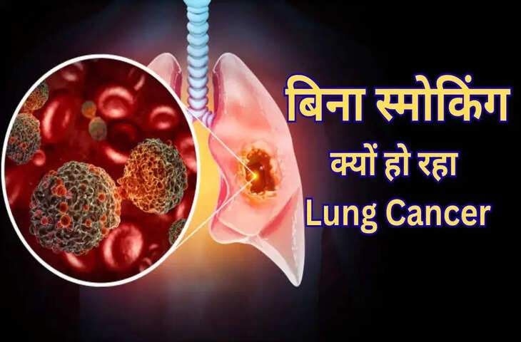 स्मोकिंग नहीं करते फिर भी बच्चे क्यों हो रहे Lung Cancer का शिकार ? जानिए इसके पीछे के बड़े कारण&nbsp;