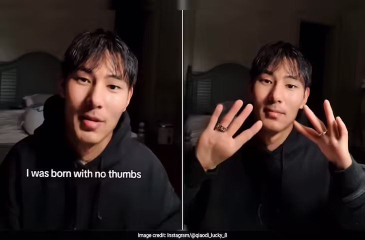 अपनी कमी को बनाया ताकत, बिना अंगूठे के जन्मे इस शख्स ने दिखाई ऐसी क्रिएटिविटी, तालियां बजाते नहीं थक रहे लोग