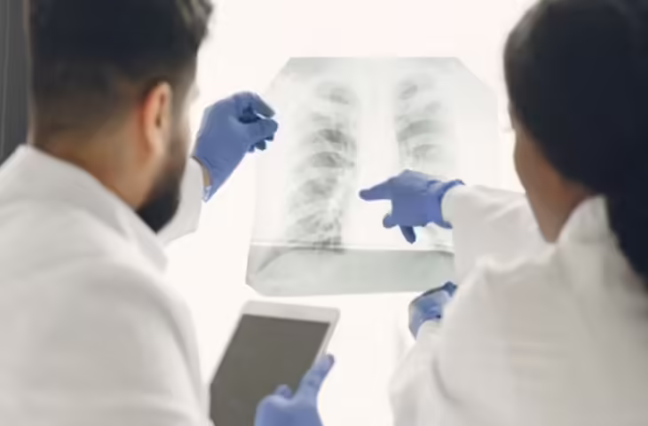 खांसी-बलगम नहीं, फिर भी निकली टीबी: एक्स्ट्रा पल्मोनरी टीबी के मामले दोगुने, स्वास्थ्य विभाग अलर्ट