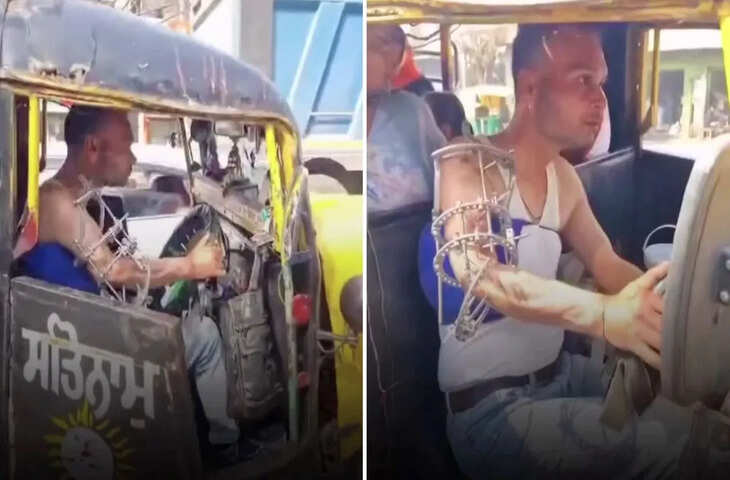 घायल हाथ के बावजूद ऑटो चलाता दिखा शख्स, वीडियो ने छुआ दिल