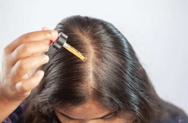 सोशल मीडिया पर छाया मिनोक्सिडिल! गंजेपन का पक्का इलाज या खतरा? जानिए एक्सपर्ट्स का सच