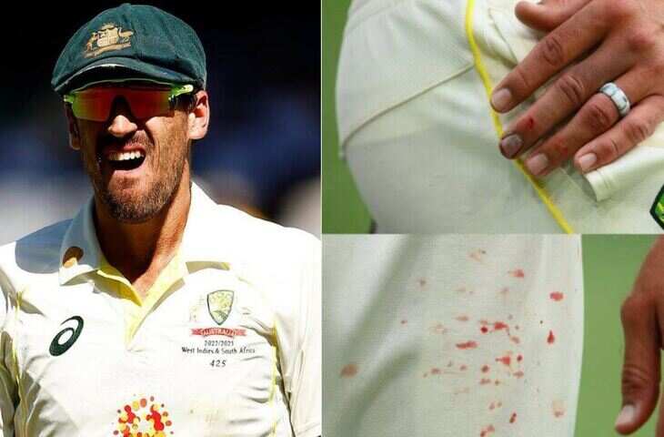 mitchell starc finger AUS VS SA-11111111111111
