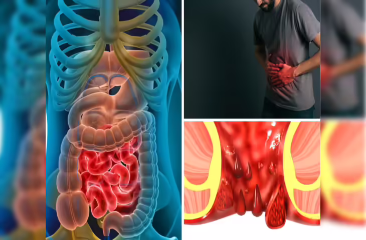 युवाओं के लिए चेतावनी!&nbsp;Colon Cancer के ये 5 शुरुआती संकेत दिखें तो तुरंत लें डॉक्टर से ले सलाह, अनदेखा करना पड़ सकता है भारी&nbsp;