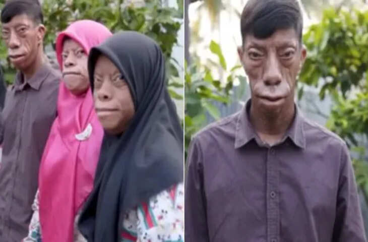 Viral Mystery: सुबह इंसान, शाम को छिपकली....' इस परिवार से दहशत में पूरा गाँव,&nbsp;वैज्ञानिक भी नहीं सुलझा पाए गुत्थी&nbsp;