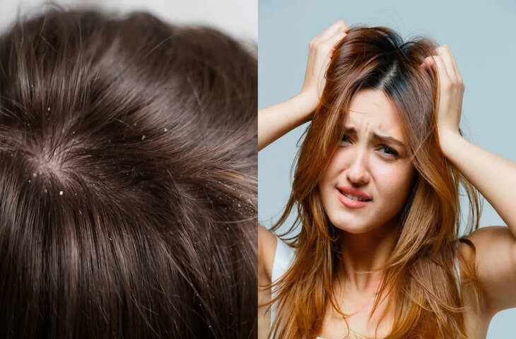 Hair Fall क्यों होता है? बालों के झड़ने के पीछे तनाव से लेकर हार्मोन तक हो सकते हैं कई कारण, डर्मेटोलॉजिस्ट ने बताया समाधान