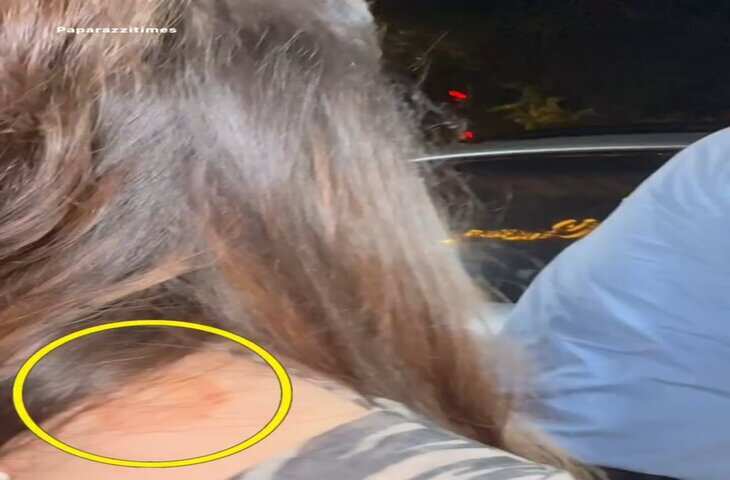 Viral Video: सचिन तेंदुलकर के कंधे पर दिखे निशानों को लेकर सोशल मीडिया पर चर्चा, सारा तेंदुलकर के वीडियो ने खींचा ध्यान