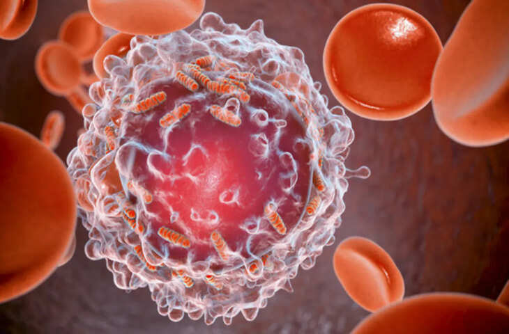 चुपके से इंसान को मौत की ओर धकेल देते है ये 6 प्रकार के कैंसर, लक्षण दिखने तक हो जाति है बहुत देर&nbsp;