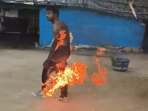 जौनपुर में युवक ने पेट्रोल छिड़ककर खुद को लगाई आग, जलते हुए सड़क पर दौड़ा; बोला- प्रधान ने बहुत मारा है