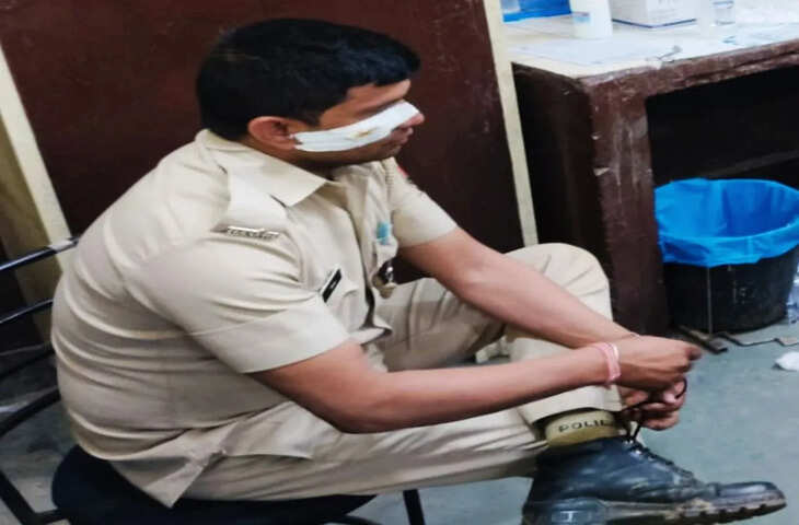बारी गांव में पुलिस टीम पर जानलेवा हमला, तीन पुलिसकर्मी घायल; जवाबी कार्रवाई में दो आरोपी गिरफ्तार
