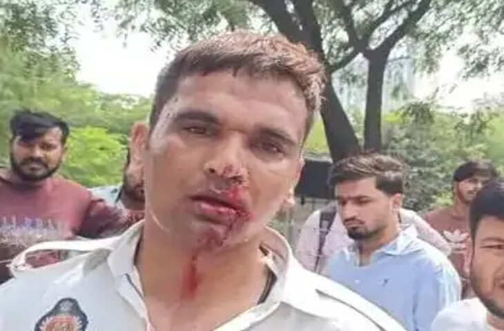 ग्रेटर नोएडा में रॉन्ग साइड से आई कार ने ट्रैफिक पुलिसकर्मी की बाइक में मारी टक्कर, गंभीर घायल