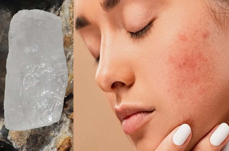 चेहरे पर रोज़ाना फिटकरी लगाने से क्या होता है,&nbsp;जाने इसके फायदे और नुकसान&nbsp;