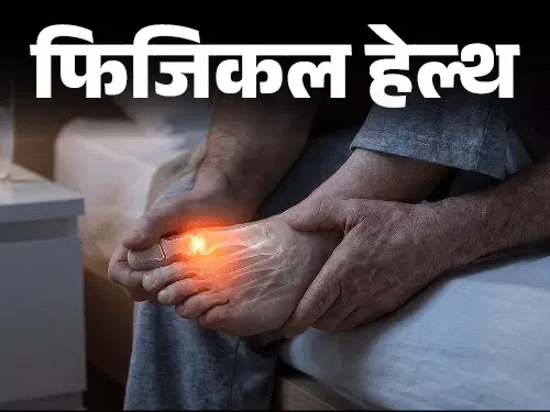 Gout Disease: सिर्फ खानपान नहीं, इन वजहों से भी बढ़ता है गाउट का खतरा; जानें लक्षण, बचाव और इलाज