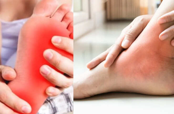 पैर के अंगूठे में दर्द और सूजन? जानिए क्या शरीर में बढ़ रहा है Uric Acid, समझें इसके शुरुआती लक्षण और सच्चाई