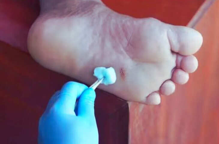 रोहतास में शराब पीकर मरीज का इलाज करने वाले डॉक्टर को शो कॉज नोटिस