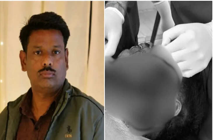 बूंदी में दर्दनाक हादसा: 11KV तार से झुलसे बाइक सवार की 3 घंटे चली सर्जरी, 100 टांके लगे