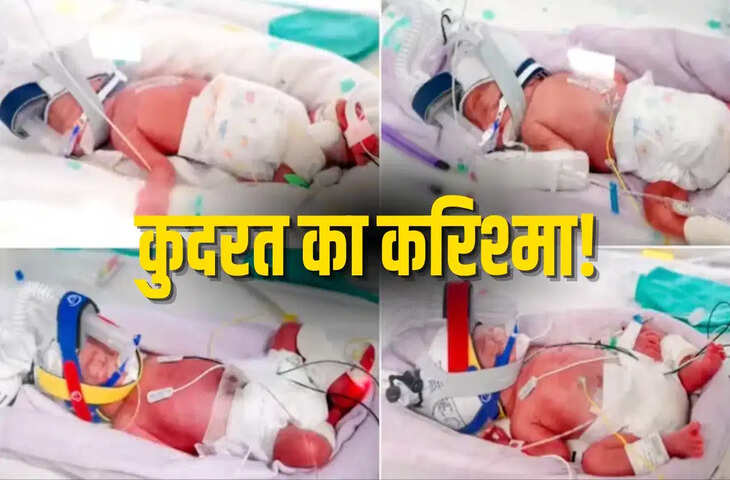 कुदरत का अनोखा करिश्मा! महिला ने दिया चार हमशक्ल बच्चियों को जन्म, लोगों के सामने रखी मजेदार शर्त