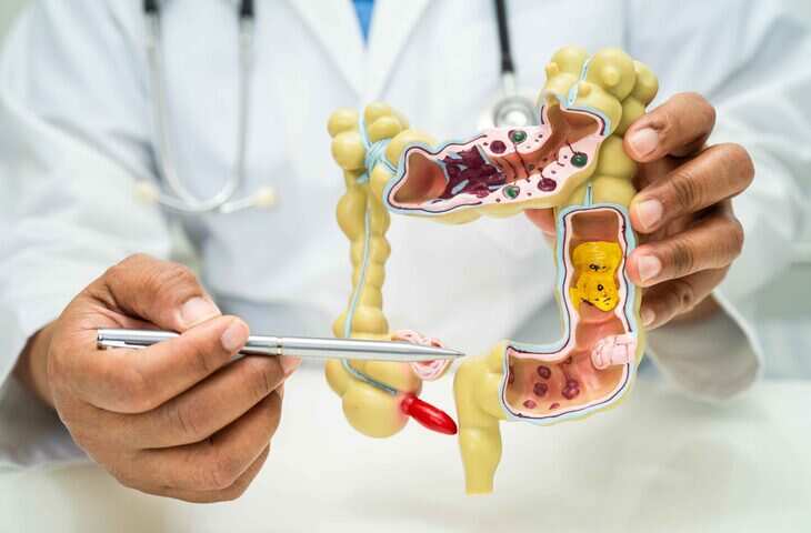Colon Cancer Alert: अगर आपके शरीर में दिख रहे ये 5 साइलेंट संकेत तो तुरंत डॉक्टर से जांच कराएं, कैंसर बन सकता है घातक​​​​​​​
