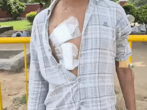 मां ने बेटे की जान बचाने के लिए दी किडनी, ट्रांसप्लांट फेल होने से मां-बेटे दोनों बीमार; 1 बीघा जमीन भी बिकी