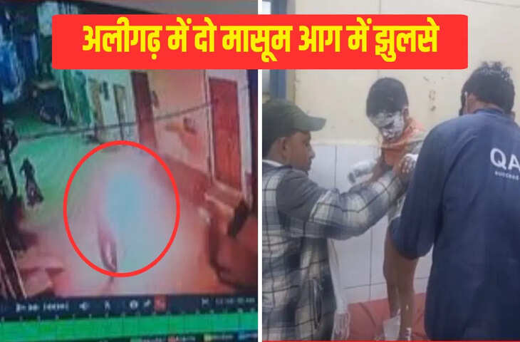 अलाव में रख दी पेट्रोल से भरी बोतल, बम की तरह धमाका; लपटों के साथ 2 बच्चे 100 मीटर तक दौड़े