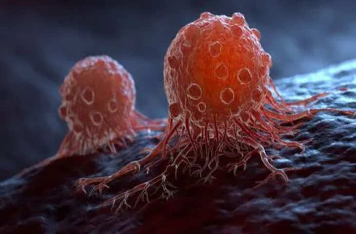 शुरुआत में खामोश रहता है कैंसर! क्यों लोग समय रहते नहीं पहचान पाते इसके शुरुआती संकेत​​​​​​​