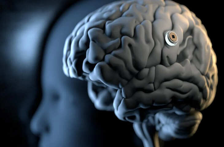 न सर्जरी, न चीर-फाड़! चीन का नया Brain-Computer Interface बदल सकता है इलाज का तरीका, 10 मिनट में इंप्लांट का दावा
