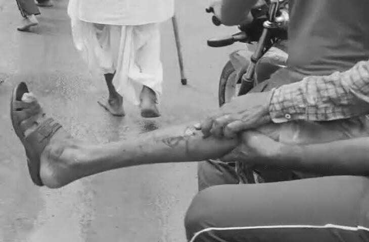 डीग में बेकाबू कार ने मचाया कहर, एक्सक्लूसिव फुटेज में देंखे 10 लोग घायल; भागते ड्राइवर की कार पलटी, आरोपी फरार