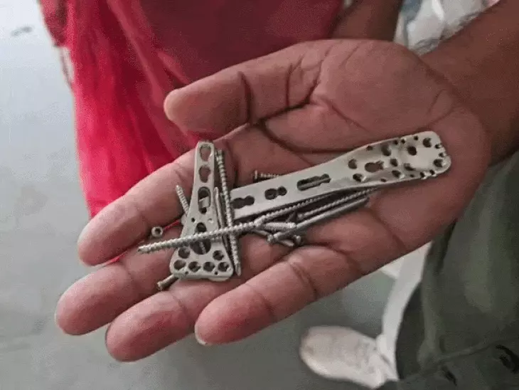 रीवा में मकान में आग लगने से महिला की मौत के मामले में नया मोड़, 18 दिन पहले कलेक्टर को दिया था ज्ञापन