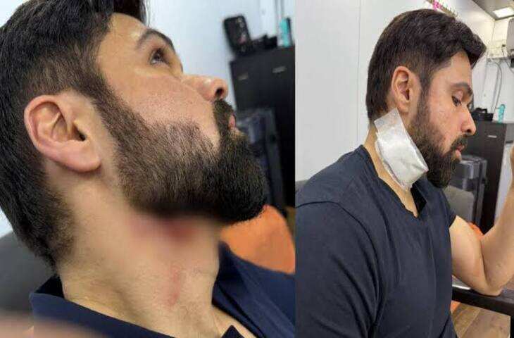 इमरान हाशमी की फिल्म के सेट पर हुआ एक्सीडेंट: बेकाबू होकर पलटी कार, वैन को मारी जोरदार टक्कर!