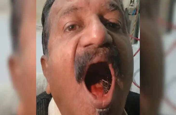 हैरान करने वाला मामला: 45 साल से मुंह में पिन रखने वाला शख्स, डॉक्टर भी रह गए दंग
