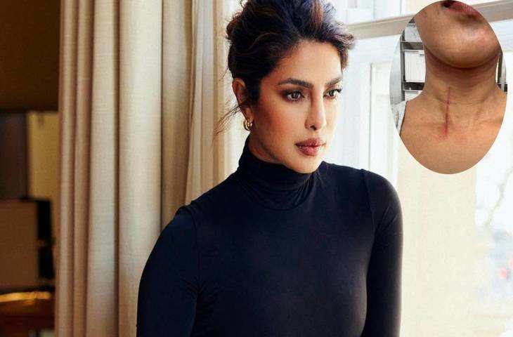 ‘द ब्लफ’ की शूटिंग के दौरान Priyanka Chopra को स्टंट करना पड़ा भारी, एक्ट्रेस को गर्दन पर लगी गंभीर चोट 