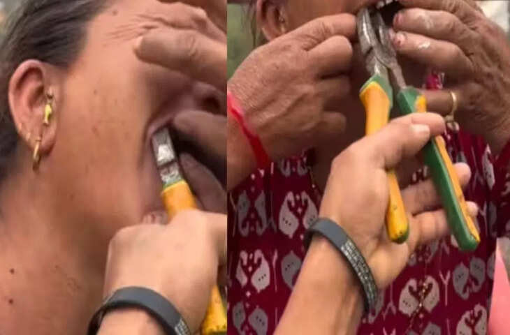 सोशल मीडिया पर वायरल वीडियो ने उड़ाए होश, बिना एनेस्थीसिया दांत निकालने का दावा