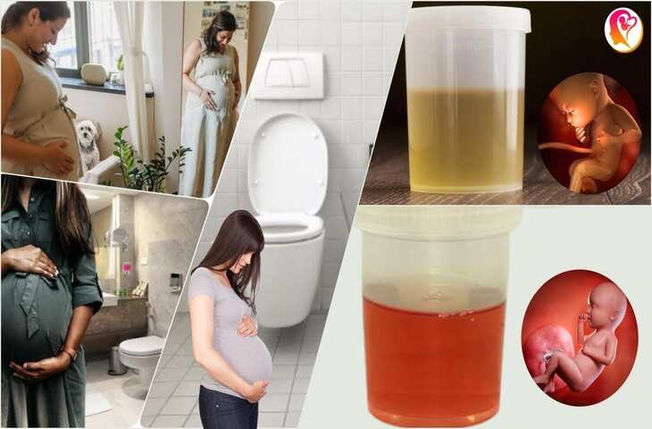 जाने Pregnancy में पेशाब का रंग क्यों बदल जाता हैं&nbsp;