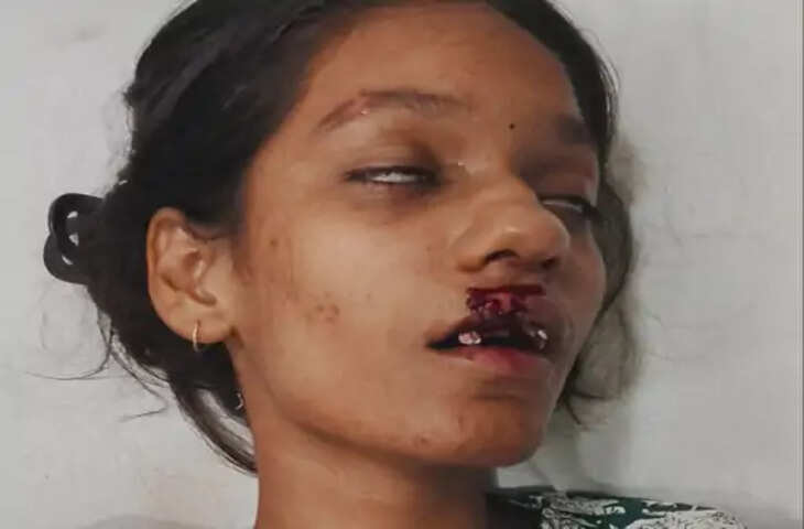 इंदिरानगर सावन महोत्सव में हादसा, टूटकर गिरा झूला; कई लोग घायल, चीख-पुकार के बीच भी नहीं रुका संचालन