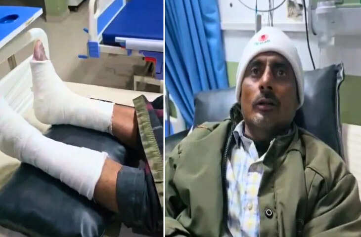 कबूलनामे के लिए थाने में युवक को मार-मारकर तोड़ डाले 5 डंडे, UP पुलिस ने तोडे दोनों पैर, ACP हटाए गए, 3 सस्पेंड