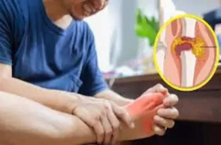 यूरिक एसिड बढ़ने पर क्या खाएं और किससे बचें? जानें एक्सपर्ट डॉक्टर की महत्वपूर्ण सलाह