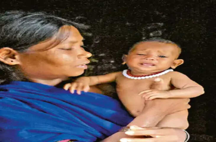 कुपोषण के रेड जोन में 19 आदिवासी बच्चों की मौत, सरकारी रिकॉर्ड में सिर्फ 8 दर्ज; 6 महीने से पोषण आहार बंद