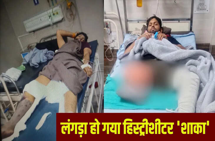 अलीगढ़ में हिस्ट्रीशीटर &lsquo;शाका&rsquo; की काटी गई टांग, सिपाही को मारी थी गोली; खुद एनकाउंटर में गंवा बैठा पैर