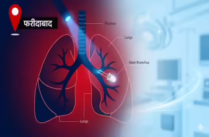 दो साल के मासूम के फेफड़े में एक हफ्ते तक फंसा रहा रिमोट का बल्ब, एडवांस ब्रोंकोस्कोपी कर निकाला गया