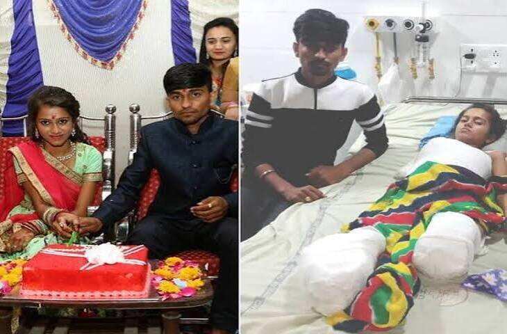 बिजली विभाग के आउटसोर्स कर्मचारियों की दर्दनाक कहानी: करंट से किसी ने हाथ गंवाया, किसी ने लाखों का इलाज कराया
