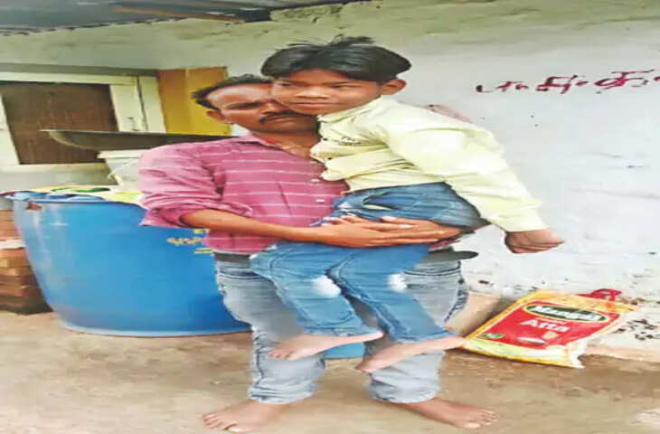 दिव्यांग का स्कूल 3 किमी दूर, बस सुविधा की कमी से परेशानी; रायसेन में एक दिन छात्र तो दूसरे दिन छात्राएं जाएंगी स्कूल