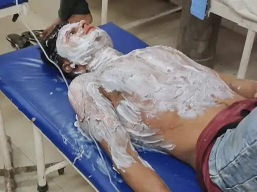 हाथरस में दर्दनाक घटना: ससुराल में युवक ने खुद को आग लगाई, गंभीर रूप से झुलसा