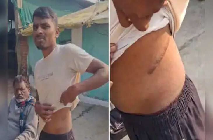 सूदखोर साहूकार की खौफनाक साजिश! किसान का 1 लाख का कर्ज बना 74 लाख और फिर निकलवा ली किडनी, जाने पूरा मामला&nbsp;