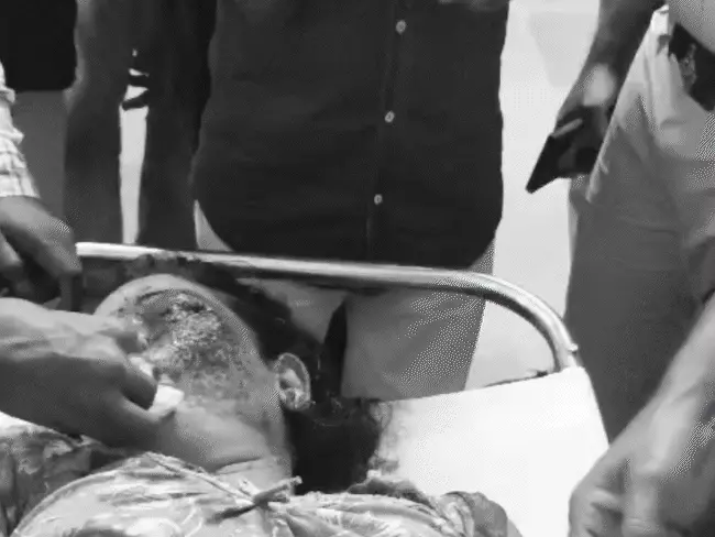 घर में घुसकर महिला के सिर में मारी गोली, तीन बच्चों के साथ कमरे में थी; बेटी बोली- नीली टी-शर्ट पहने युवक ने किया हमला