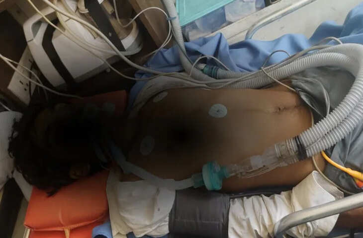 भिवाड़ी में पुलिस बर्बरता पर बवाल: नाबालिग दलित बालक वेंटिलेटर पर, थाना प्रभारी सहित 4 पुलिसकर्मियों पर FIR