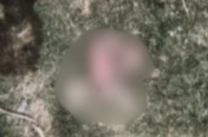 दरभंगा DMCH में मानवता तार-तार: नाले में पड़ा नवजात का शव, कुत्तों ने नोच-नोचकर खाया; दिल दहला देगा मामला